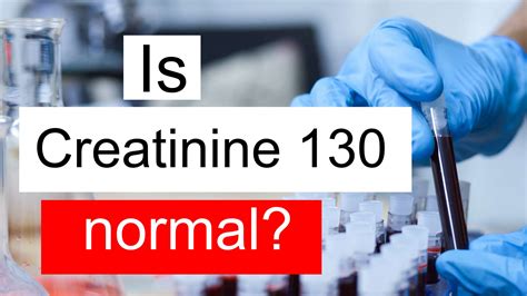 130 lv|creatinine level 130.